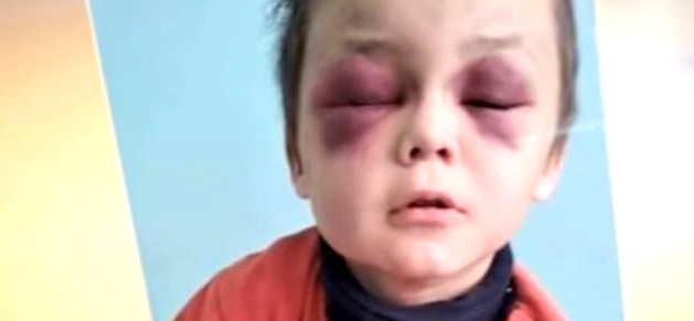 За катування 6-річного пасинка мачуха відправилася у в'язницю