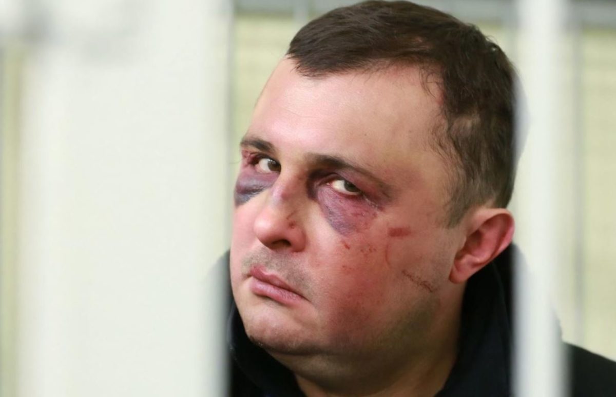Адвокат екс-депутата Шепелева прокоментував 7-річний термін для свого підзахисного