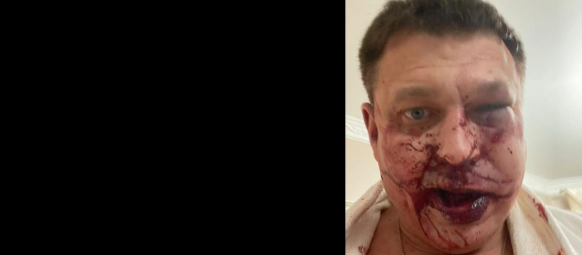 Поліція не знайшла бандитів, які напали на будинок мера Броварів