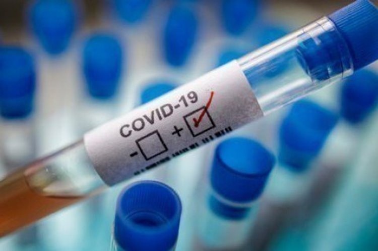 Евросовет принял решение о взаимном признании результатов тестов на Covid-19 в странах ЕС