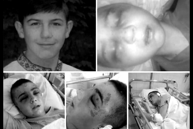 Рецидивисту, избившему 16-летнего подростка до реанимации, грозит долгий срок