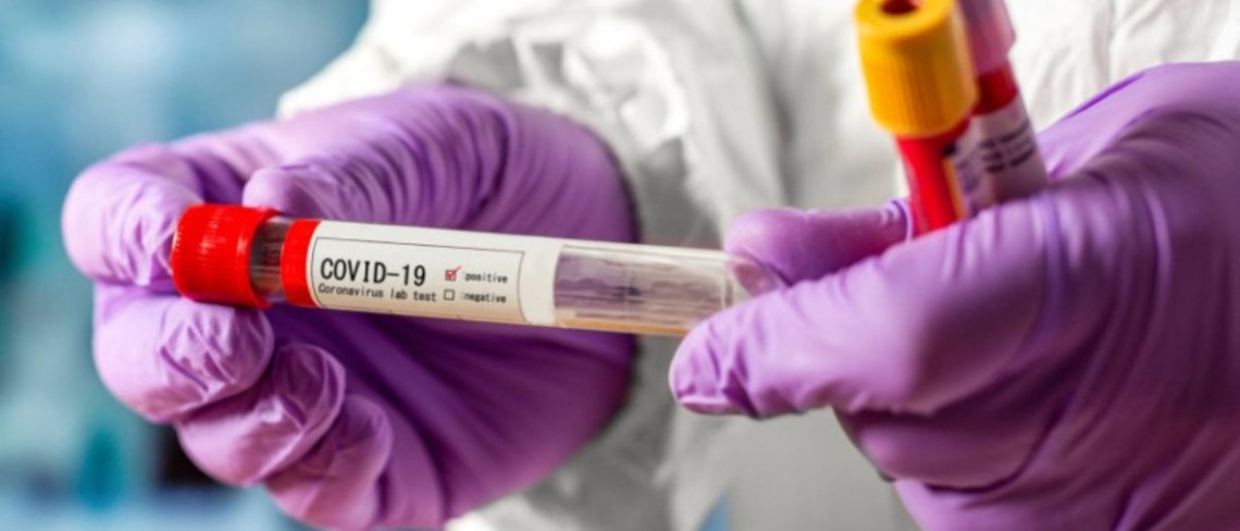 Степанов озвучил количество вакцины Pfizer, которую получит Украина в мае